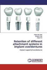 Retention of different attachment systems in implant overdentures