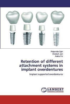 Retention of different attachment systems in implant overdentures - Polysmita Ojah,Shailesh Jain,Ankita Pal - cover