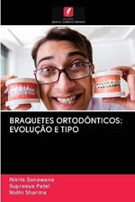 Braquetes Ortodonticos: Evolucao E Tipo