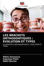 Les Brackets Orthodontiques: Evolution Et Types