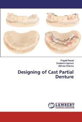 Designing of Cast Partial Denture - Pragati Rawat,Swatantra Agarwal,Abhinav Sharma - cover