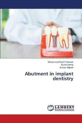 Abutment in implant dentistry - Mohammad Kashif Noorani,Sumit Verma,Kumar Adarsh - cover