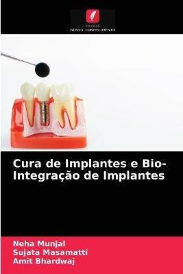 Cura de Implantes e Bio- Integracao de Implantes - Neha Munjal,Sujata Masamatti,Amit Bhardwaj - cover