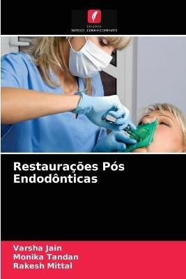 Restauracoes Pos Endodonticas - Varsha Jain,Monika Tandan,Rakesh Mittal - cover