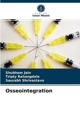 Osseointegration - Shubham Jain,Tripty Rahangdale,Saurabh Shrivastava - cover