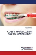 Class II Malocclusion and Its Management