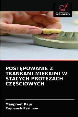 PostEpowanie Z Tkankami MiEkkimi W Stalych Protezach CzESciowych - Manpreet Kaur,Rajneesh Parimoo - cover