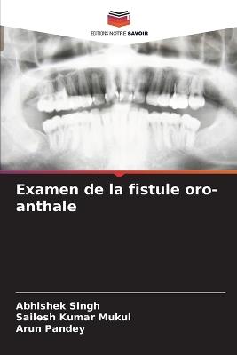 Examen de la fistule oro-anthale - Abhishek Singh,Sailesh Kumar Mukul,Arun Pandey - cover