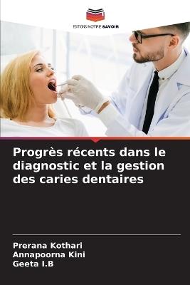 Progrès récents dans le diagnostic et la gestion des caries dentaires - Prerana Kothari,Annapoorna Kini,Geeta I B - cover