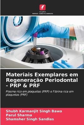Materiais Exemplares em Regeneracao Periodontal - PRP & PRF - Shubh Karmanjit Singh Bawa,Parul Sharma,Shamsher Singh Sandlas - cover