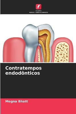 Contratempos endodonticos - Megna Bhatt - cover