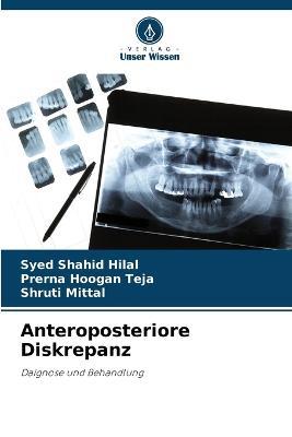 Anteroposteriore Diskrepanz - Syed Shahid Hilal,Prerna Hoogan Teja,Shruti Mittal - cover