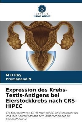 Expression des Krebs-Testis-Antigens bei Eierstockkrebs nach CRS-HIPEC - Ray,Premanand N - cover