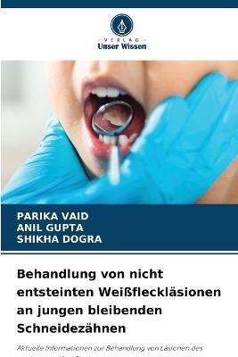 Behandlung von nicht entsteinten Weissflecklasionen an jungen bleibenden Schneidezahnen - Parika Vaid,Anil Gupta,Shikha Dogra - cover