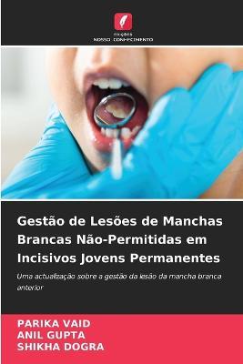 Gestao de Lesoes de Manchas Brancas Nao-Permitidas em Incisivos Jovens Permanentes - Parika Vaid,Anil Gupta,Shikha Dogra - cover