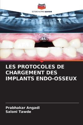 Les Protocoles de Chargement Des Implants Endo-Osseux - Prabhakar Angadi,Saloni Tawde - cover