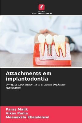 Attachments em implantodontia - Paras Malik,Vikas Punia,Meenakshi Khandelwal - cover