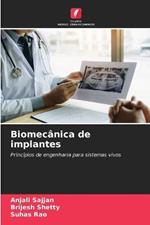 Biomecanica de implantes