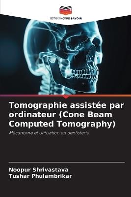 Tomographie assistée par ordinateur (Cone Beam Computed Tomography) - Noopur Shrivastava,Tushar Phulambrikar - cover