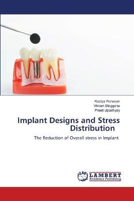 Implant Designs and Stress Distribution - Raziya Perween,Vikram Blaggana,Preeti Upadhyay - cover