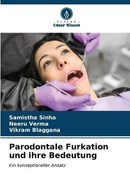 Parodontale Furkation und ihre Bedeutung - Samistha Sinha,Neeru Verma,Vikram Blaggana - cover