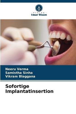 Sofortige Implantatinsertion - Neeru Verma,Samistha Sinha,Vikram Blaggana - cover