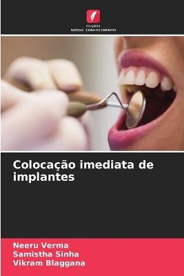 Colocação imediata de implantes - Neeru Verma,Samistha Sinha,Vikram Blaggana - cover