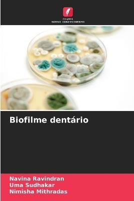 Biofilme dentário - Navina Ravindran,Uma Sudhakar,Nimisha Mithradas - cover