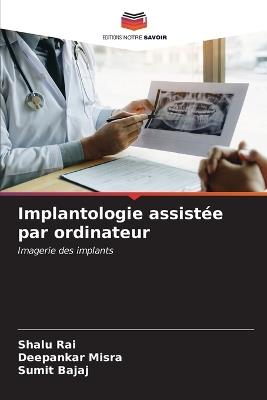 Implantologie assistée par ordinateur - Shalu Rai,Deepankar Misra,Sumit Bajaj - cover