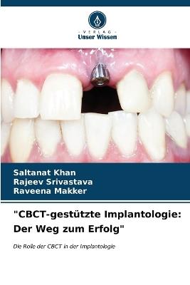 "CBCT-gestützte Implantologie: Der Weg zum Erfolg" - Saltanat Khan,Rajeev Srivastava,Raveena Makker - cover