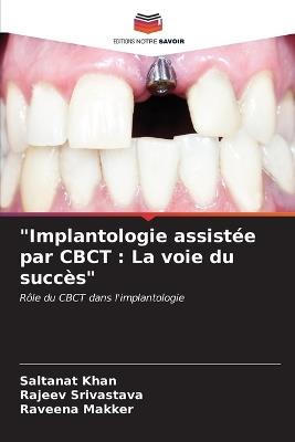 "Implantologie assistée par CBCT: La voie du succès" - Saltanat Khan,Rajeev Srivastava,Raveena Makker - cover