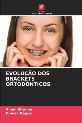 Evolução DOS Brackets Ortodônticos - Aman Sharma,Dinesh Bagga - cover