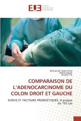 Comparaison de l'Adenocarcinome Du Colon Droit Et Gauche - Mohamed Taieb Frikha,Amine Zouari,Ahmed Tlili - cover