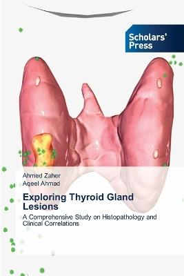 Exploring Thyroid Gland Lesions - Ahmed Zaher,Aqeel Ahmad - cover