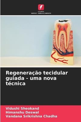 Regeneração tecidular guiada - uma nova técnica - Vidushi Sheokand,Himanshu Deswal,Vandana Srikrishna Chadha - cover