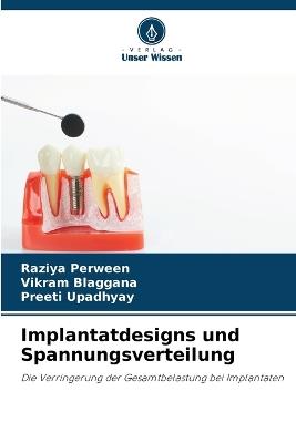 Implantatdesigns und Spannungsverteilung - Raziya Perween,Vikram Blaggana,Preeti Upadhyay - cover