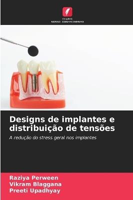 Designs de implantes e distribuição de tensões - Raziya Perween,Vikram Blaggana,Preeti Upadhyay - cover