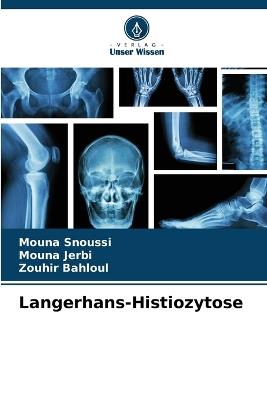 Langerhans-Histiozytose - Mouna Snoussi,Mouna Jerbi,Zouhir Bahloul - cover