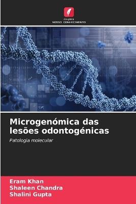 Microgenómica das lesões odontogénicas - Eram Khan,Shaleen Chandra,Shalini Gupta - cover