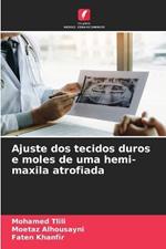 Ajuste dos tecidos duros e moles de uma hemi-maxila atrofiada