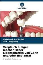 Vergleich einiger mechanischer Eigenschaften von Zahn und/oder Implantat