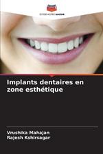 Implants dentaires en zone esth?tique