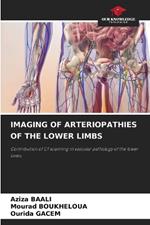 Imaging of Arteriopathies of the Lower Limbs