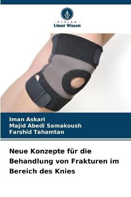 Neue Konzepte f?r die Behandlung von Frakturen im Bereich des Knies - Iman Askari,Majid Abedi Samakoush,Farshid Tahamtan - cover