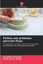 Falhas em pr?teses parciais fixas