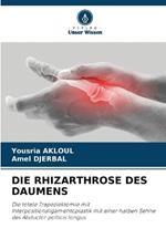 Die Rhizarthrose Des Daumens