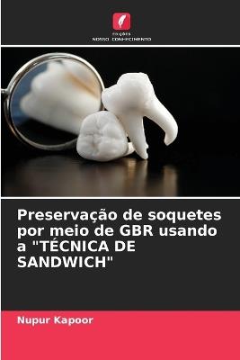 Preserva??o de soquetes por meio de GBR usando a "T?CNICA DE SANDWICH" - Nupur Kapoor - cover