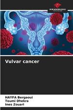 Vulvar cancer