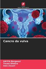 Cancro da vulva