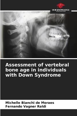 Assessment of vertebral bone age in individuals with Down Syndrome - Michelle Bianchi de Moraes,Fernando Vagner Raldi - cover